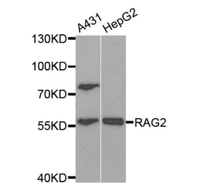 Western blot - RAG2 Antibody from Signalway Antibody (32931) - Antibodies.com