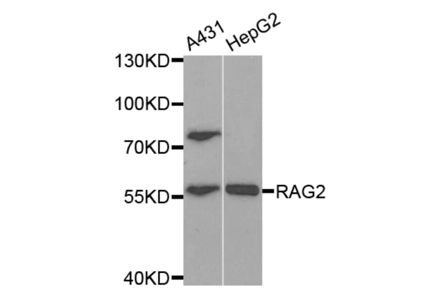 Western blot - RAG2 Antibody from Signalway Antibody (32931) - Antibodies.com