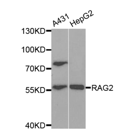 Western blot - RAG2 Antibody from Signalway Antibody (32931) - Antibodies.com