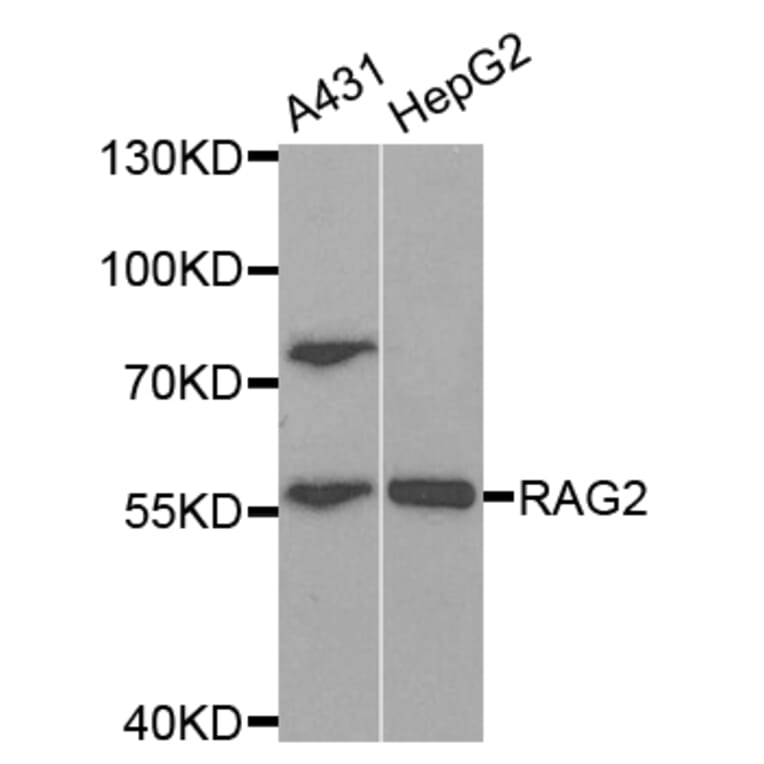 Western blot - RAG2 Antibody from Signalway Antibody (32931) - Antibodies.com