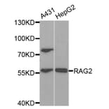 Western blot - RAG2 Antibody from Signalway Antibody (32931) - Antibodies.com