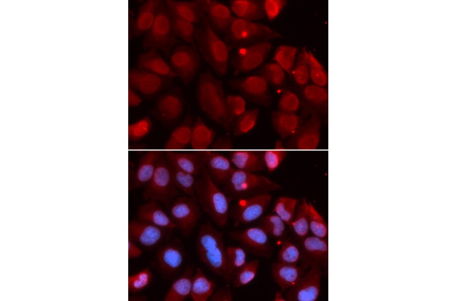 Immunofluorescence - RAG2 Antibody from Signalway Antibody (32931) - Antibodies.com