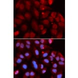 Immunofluorescence - RAG2 Antibody from Signalway Antibody (32931) - Antibodies.com