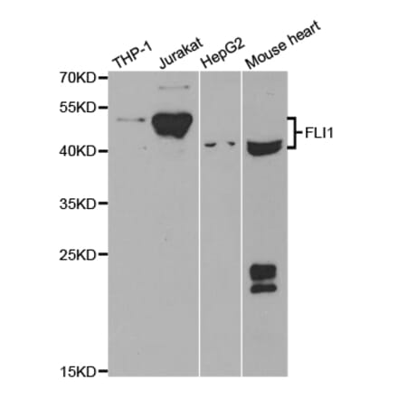 Western blot - FLI1 Antibody from Signalway Antibody (32943) - Antibodies.com