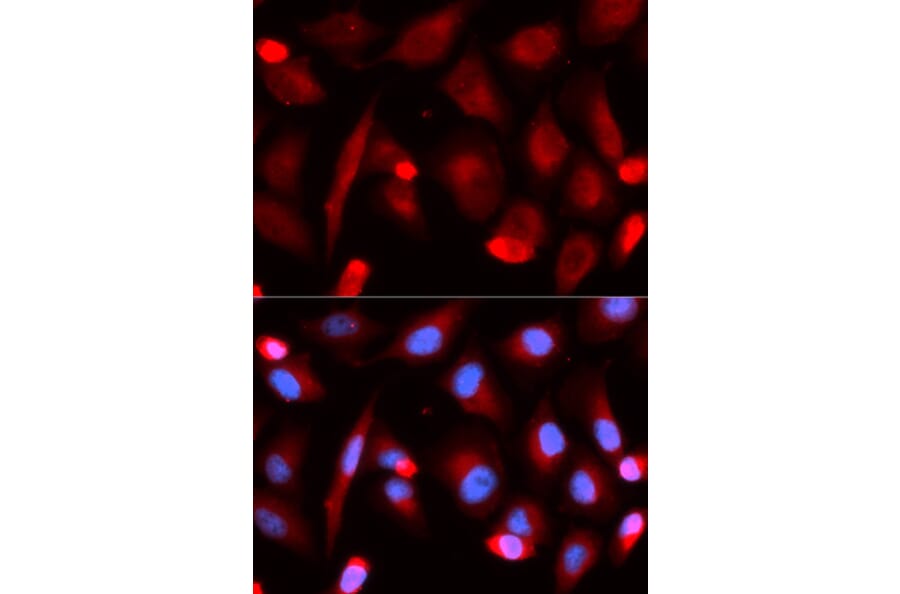 Immunofluorescence - FLI1 Antibody from Signalway Antibody (32943) - Antibodies.com