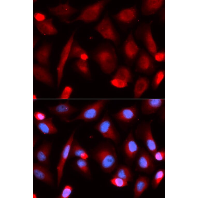 Immunofluorescence - FLI1 Antibody from Signalway Antibody (32943) - Antibodies.com