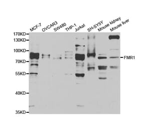 Western blot - FMR1 Antibody from Signalway Antibody (32944) - Antibodies.com