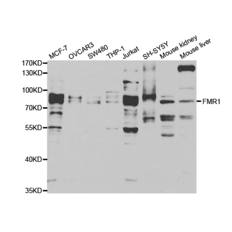 Western blot - FMR1 Antibody from Signalway Antibody (32944) - Antibodies.com