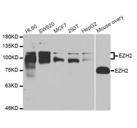 Western blot - EZH2 Antibody from Signalway Antibody (33009) - Antibodies.com