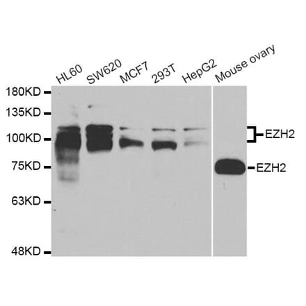 Western blot - EZH2 Antibody from Signalway Antibody (33009) - Antibodies.com