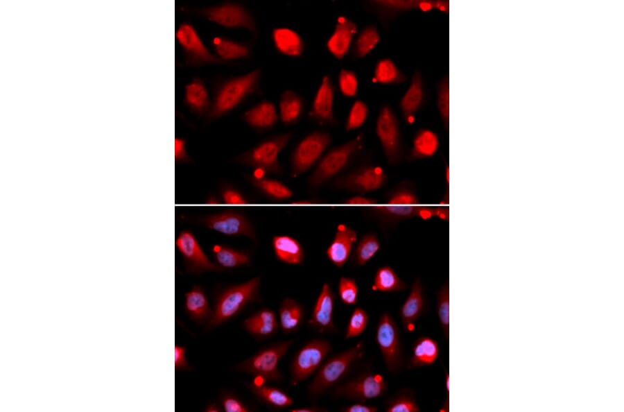 Immunofluorescence - EZH2 Antibody from Signalway Antibody (33009) - Antibodies.com