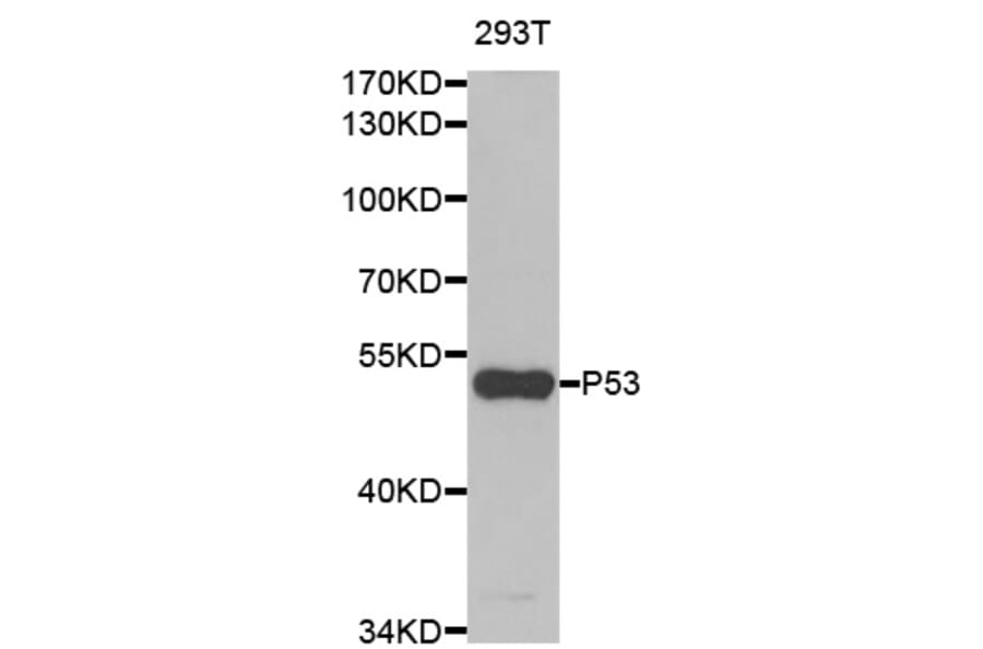 Western blot - TP53 Antibody from Signalway Antibody (33023) - Antibodies.com