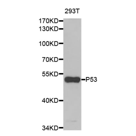 Western blot - TP53 Antibody from Signalway Antibody (33023) - Antibodies.com