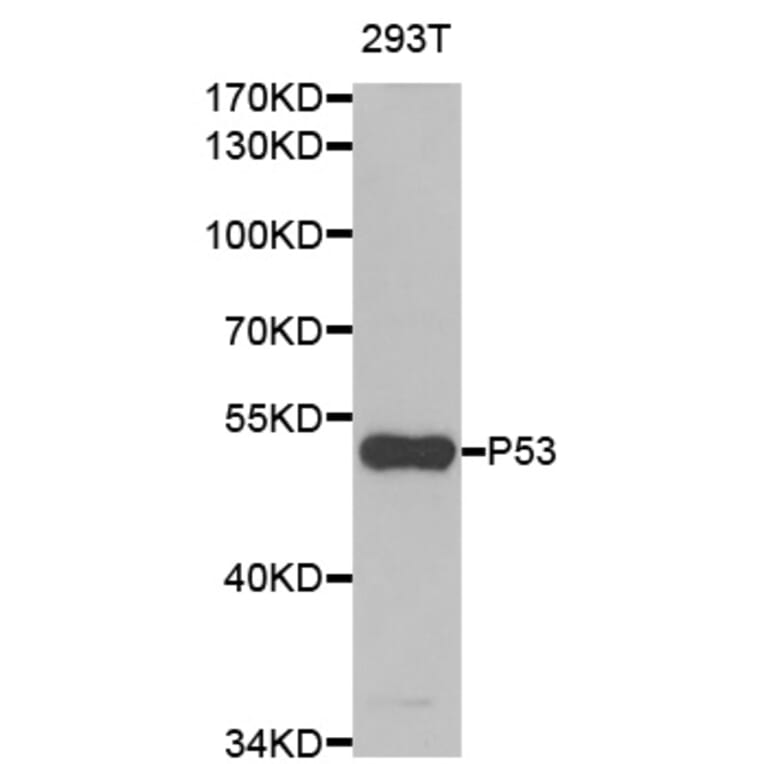 Western blot - TP53 Antibody from Signalway Antibody (33023) - Antibodies.com