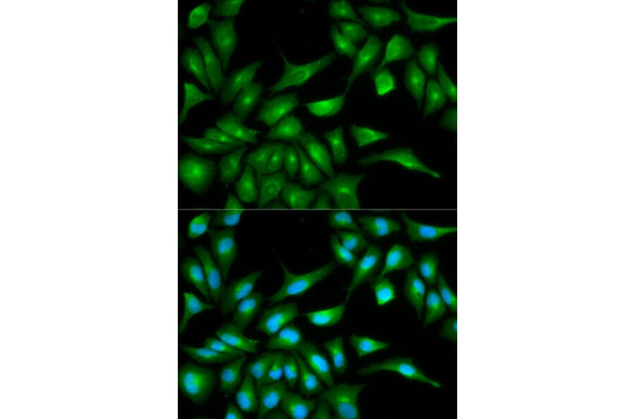 Immunofluorescence - TP53 Antibody from Signalway Antibody (33023) - Antibodies.com