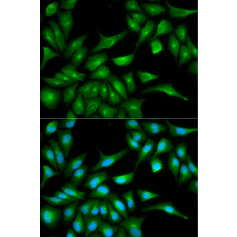 Immunofluorescence - TP53 Antibody from Signalway Antibody (33023) - Antibodies.com