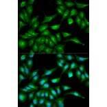 Immunofluorescence - TP53 Antibody from Signalway Antibody (33023) - Antibodies.com
