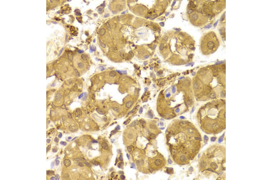 Immunohistochemistry - TP53 Antibody from Signalway Antibody (33023) - Antibodies.com