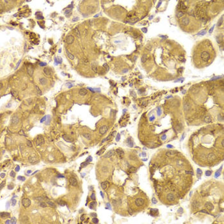 Immunohistochemistry - TP53 Antibody from Signalway Antibody (33023) - Antibodies.com