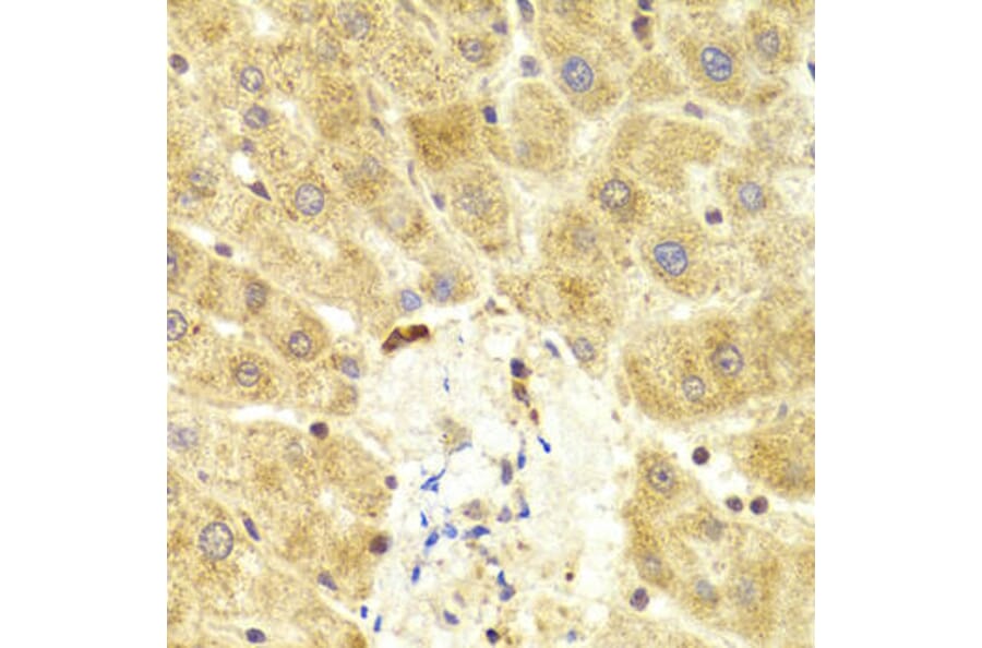Immunohistochemistry - TP53 Antibody from Signalway Antibody (33023) - Antibodies.com