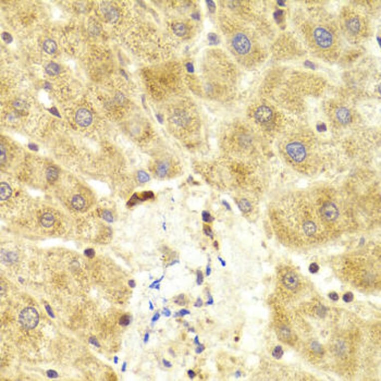 Immunohistochemistry - TP53 Antibody from Signalway Antibody (33023) - Antibodies.com
