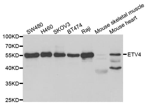 Western blot analysis of extracts of various cell lines, using ETV4 antibody.