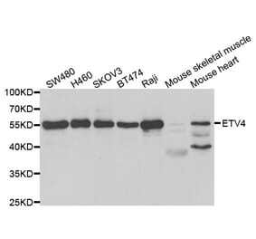 Western blot - ETV4 Antibody from Signalway Antibody (33049) - Antibodies.com