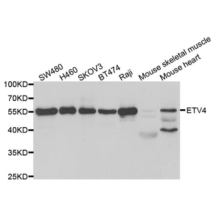 Western blot - ETV4 Antibody from Signalway Antibody (33049) - Antibodies.com