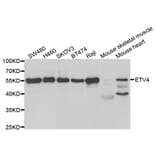 Western blot - ETV4 Antibody from Signalway Antibody (33049) - Antibodies.com