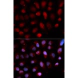 Immunofluorescence - ETV4 Antibody from Signalway Antibody (33049) - Antibodies.com