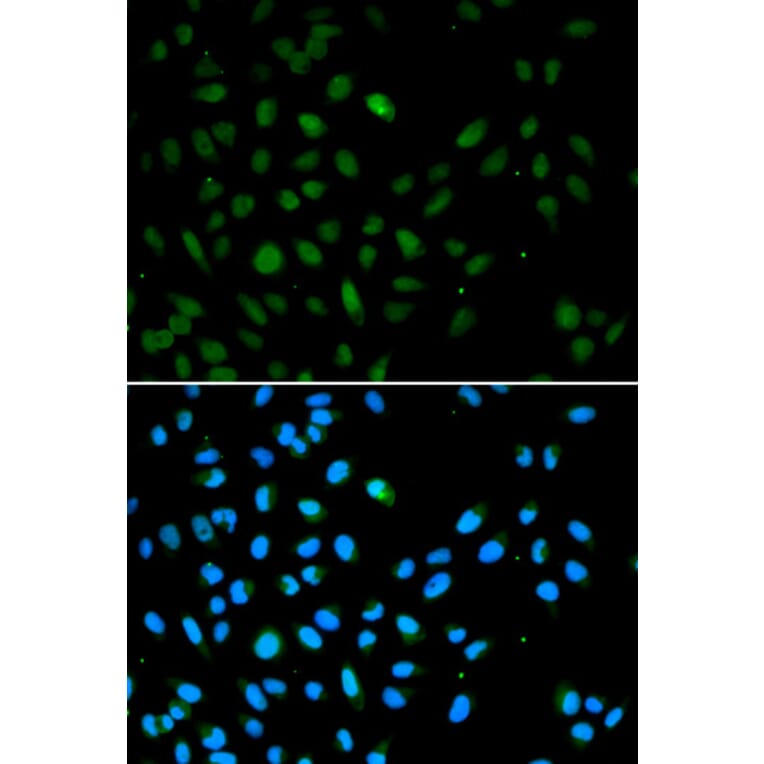 Immunofluorescence - EZH1 Antibody from Signalway Antibody (33064) - Antibodies.com