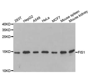 Western blot - FIS1 Antibody from Signalway Antibody (33067) - Antibodies.com