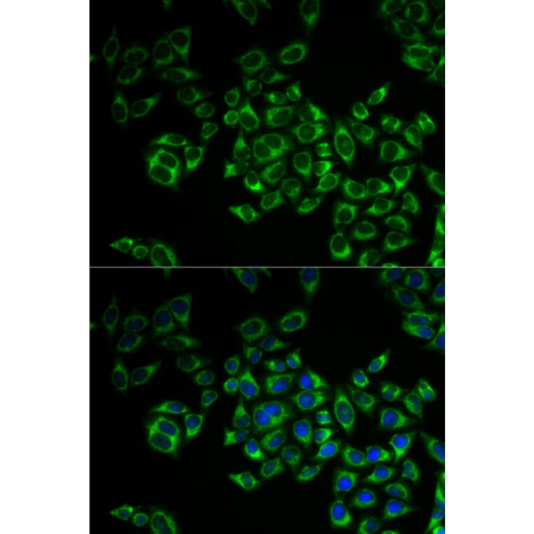 Immunofluorescence - FIS1 Antibody from Signalway Antibody (33067) - Antibodies.com