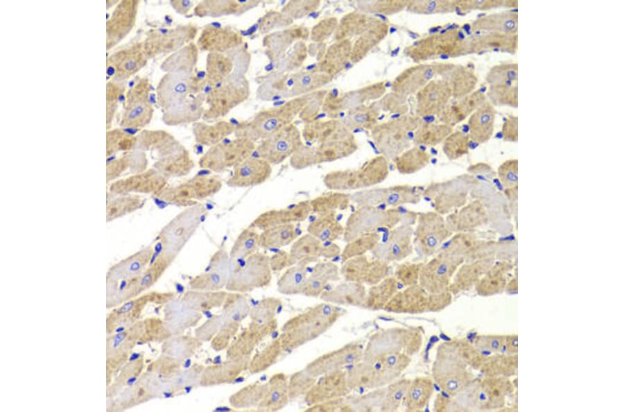 Immunohistochemistry - FIS1 Antibody from Signalway Antibody (33067) - Antibodies.com
