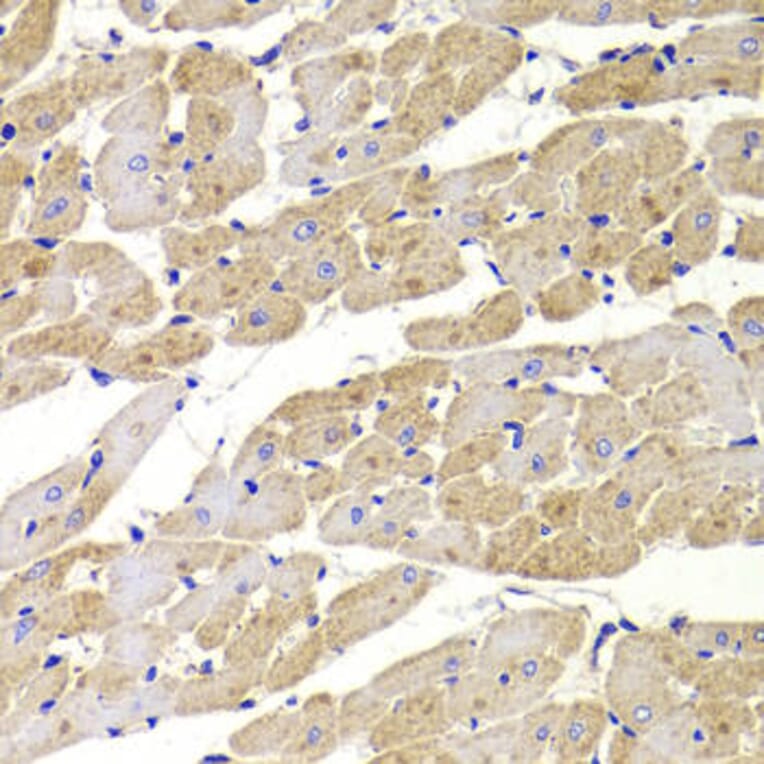 Immunohistochemistry - FIS1 Antibody from Signalway Antibody (33067) - Antibodies.com