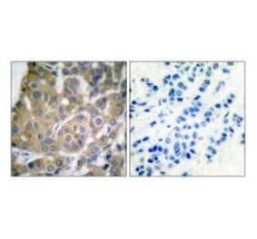 Immunohistochemistry - Cox2 Antibody from Signalway Antibody (33345) - Antibodies.com