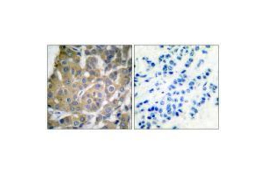 Immunohistochemistry - Cox2 Antibody from Signalway Antibody (33345) - Antibodies.com