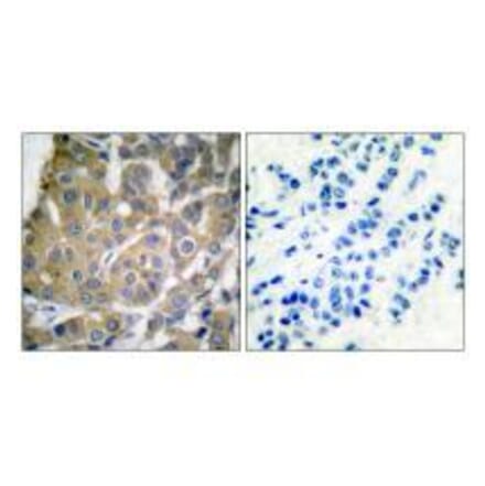 Immunohistochemistry - Cox2 Antibody from Signalway Antibody (33345) - Antibodies.com