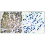 Immunohistochemistry - Cox2 Antibody from Signalway Antibody (33345) - Antibodies.com