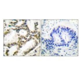 Immunohistochemistry - DJ-1 Antibody from Signalway Antibody (33356) - Antibodies.com