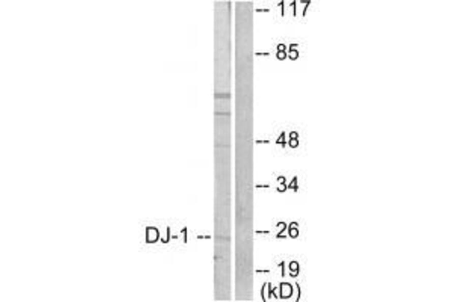Western blot - DJ-1 Antibody from Signalway Antibody (33356) - Antibodies.com