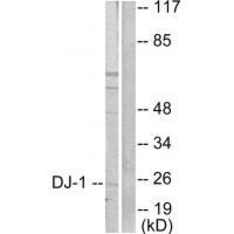 Western blot - DJ-1 Antibody from Signalway Antibody (33356) - Antibodies.com