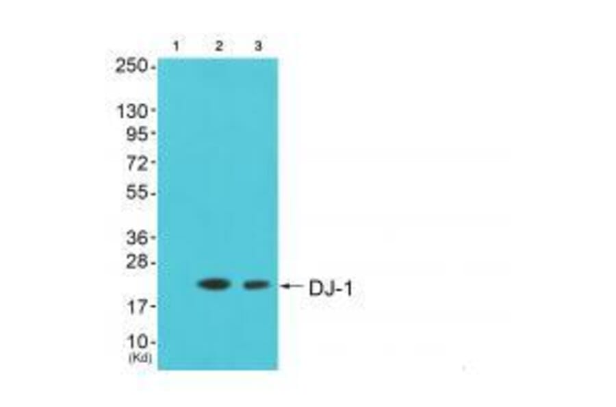 Western blot - DJ-1 Antibody from Signalway Antibody (33356) - Antibodies.com