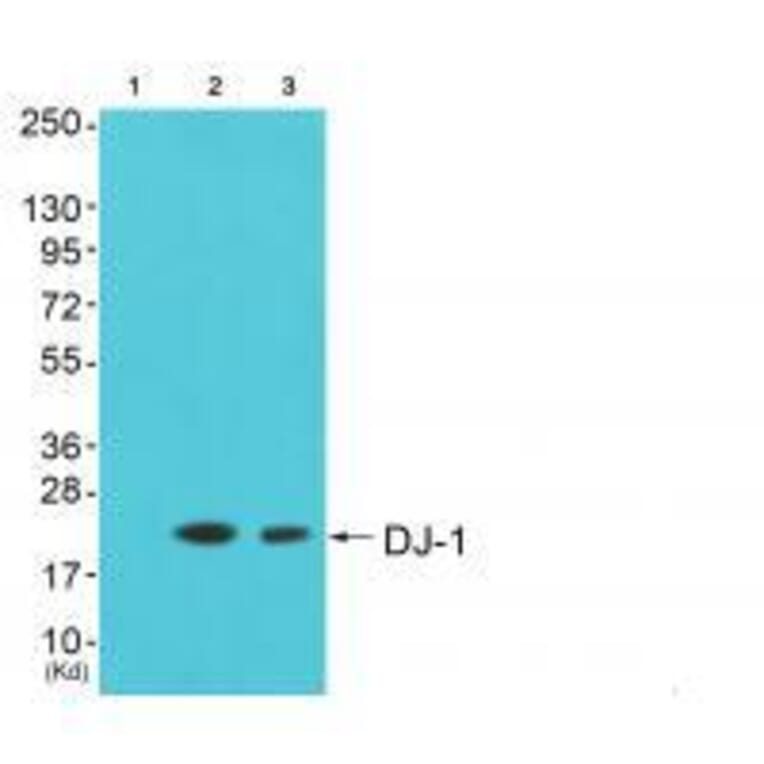 Western blot - DJ-1 Antibody from Signalway Antibody (33356) - Antibodies.com