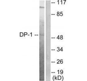 Western blot - DP-1 Antibody from Signalway Antibody (33359) - Antibodies.com
