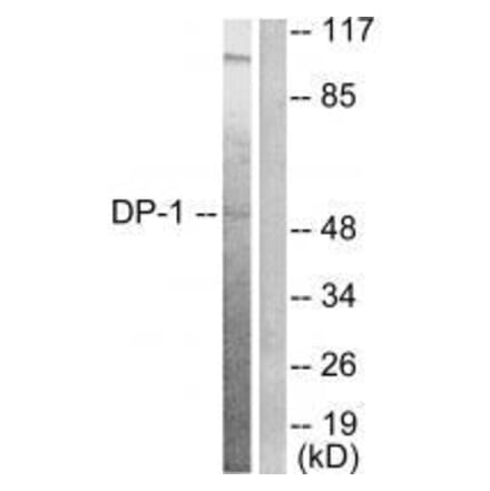 Western blot - DP-1 Antibody from Signalway Antibody (33359) - Antibodies.com