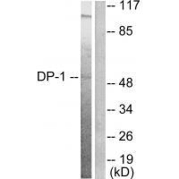 Western blot - DP-1 Antibody from Signalway Antibody (33359) - Antibodies.com