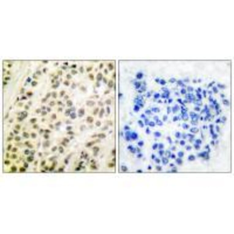 Immunohistochemistry - DP-1 Antibody from Signalway Antibody (33359) - Antibodies.com