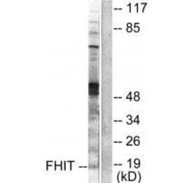 Western blot - FHIT Antibody from Signalway Antibody (33374) - Antibodies.com