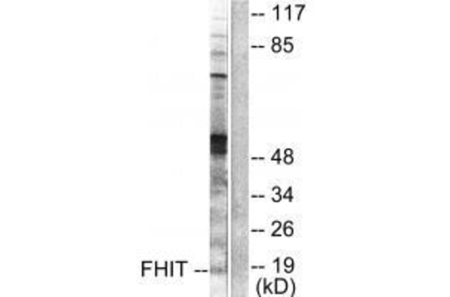 Western blot - FHIT Antibody from Signalway Antibody (33374) - Antibodies.com